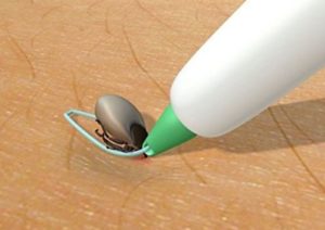 Zecken auf dem Pudel mit der Zeckenschlinge entfernen